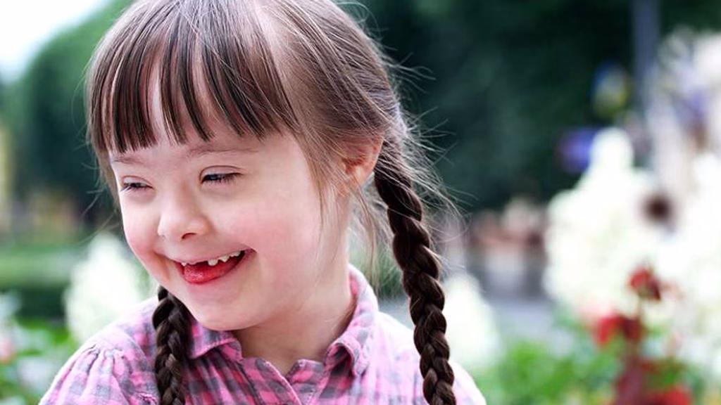 Approximately 7 or 8 year old girl with downs syndrome smiling and facing left. She has dark brown braided pigtails and is missing her front baby teeth making her smile even more youthful and fun.